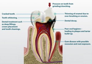 Dental Treatment