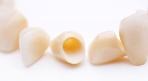 dental crowns