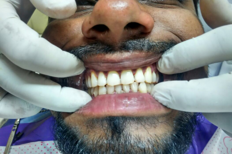 dental delhi