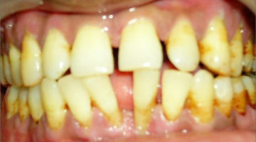 dental delhi