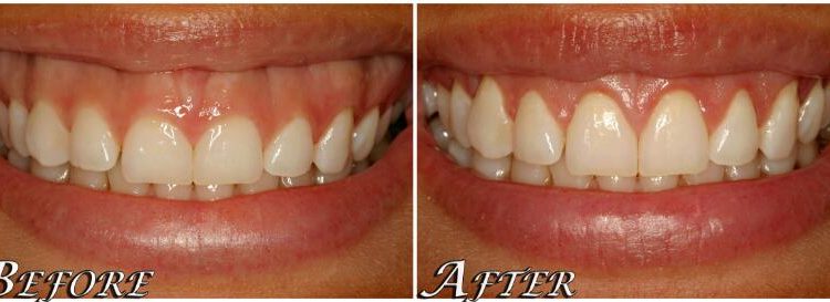 dental delhi