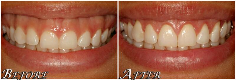 dental delhi