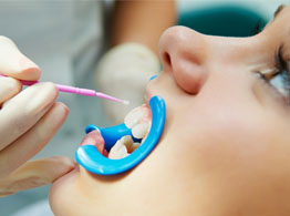 Best Dental Clinic in India