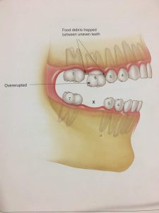 dental delhi