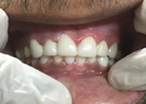 Case5 After