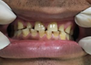 Case5 Before