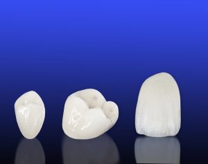 Ceramic-crown-2