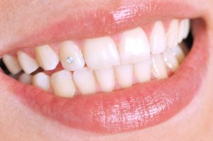 Tooth Diamonds