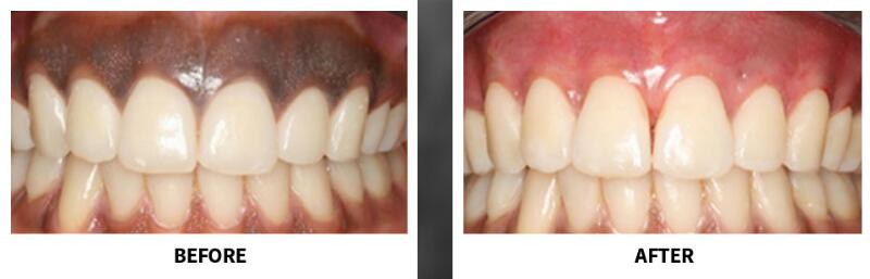 dental delhi