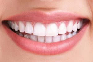 teeth whitening after