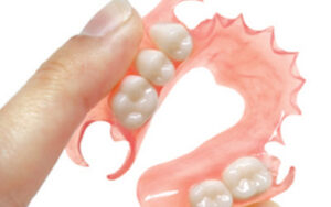 Partial Denture