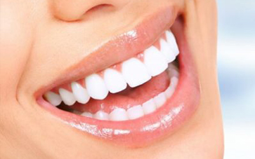 Porcelain VS Composite Veneers