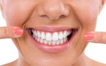 Common Cosmetic Dental Treatments