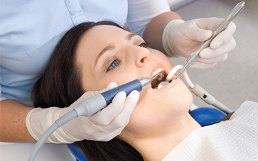 Teeth Scaling Myths