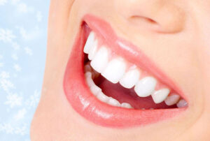 SCALING POLISHING IMPROVE TEETH COLOR