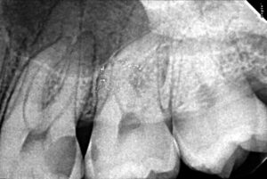 Endodontist before