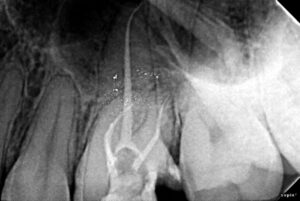 Endodontists After