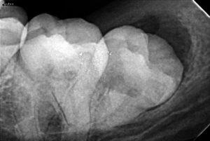 Oral Maxillofacial