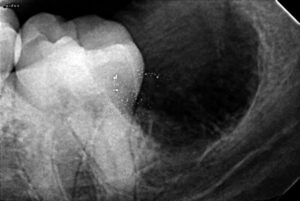 Oral and Maxillofacial Surgeon