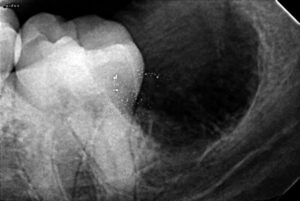 Oral and Maxillofacial Surgeon