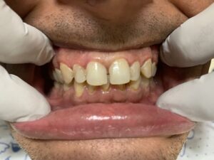 Prosthodontists Before