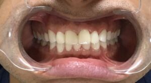 Prosthodontist After