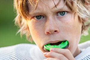 mouth guard