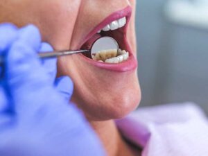 Open Female Mouth During Oral Checkup At The Dentist. Selective