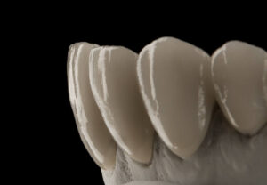 Zirconia Emax