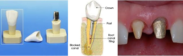 E Post core