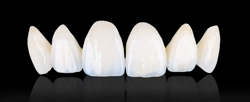 CAD CAM CROWNS