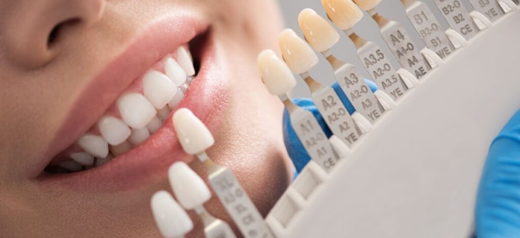 Different types of dental crowns: types & benefits