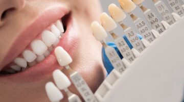 Different types of dental crowns: types & benefits