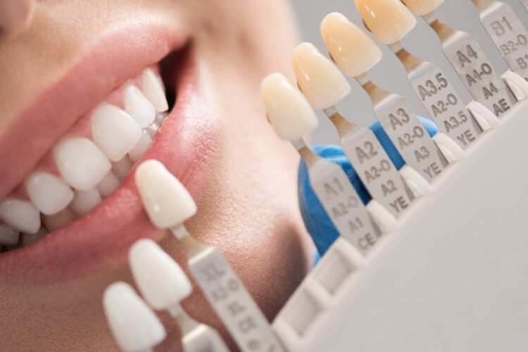 Different types of dental crowns: types & benefits