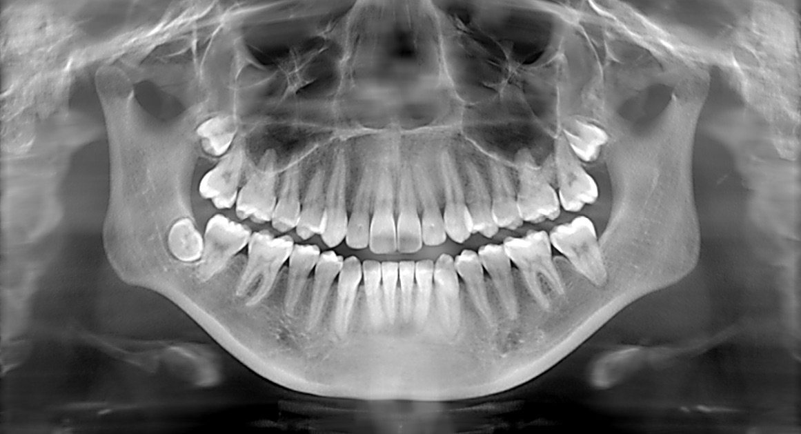 Dental X Ray Mesa Az