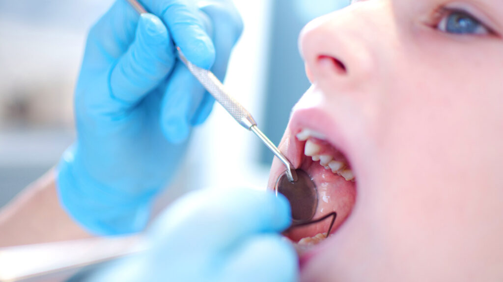 Best Treatment Options Available For Tooth Decay