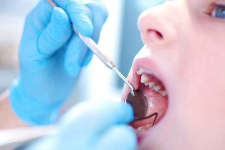 Best Treatment Options Available For Tooth Decay