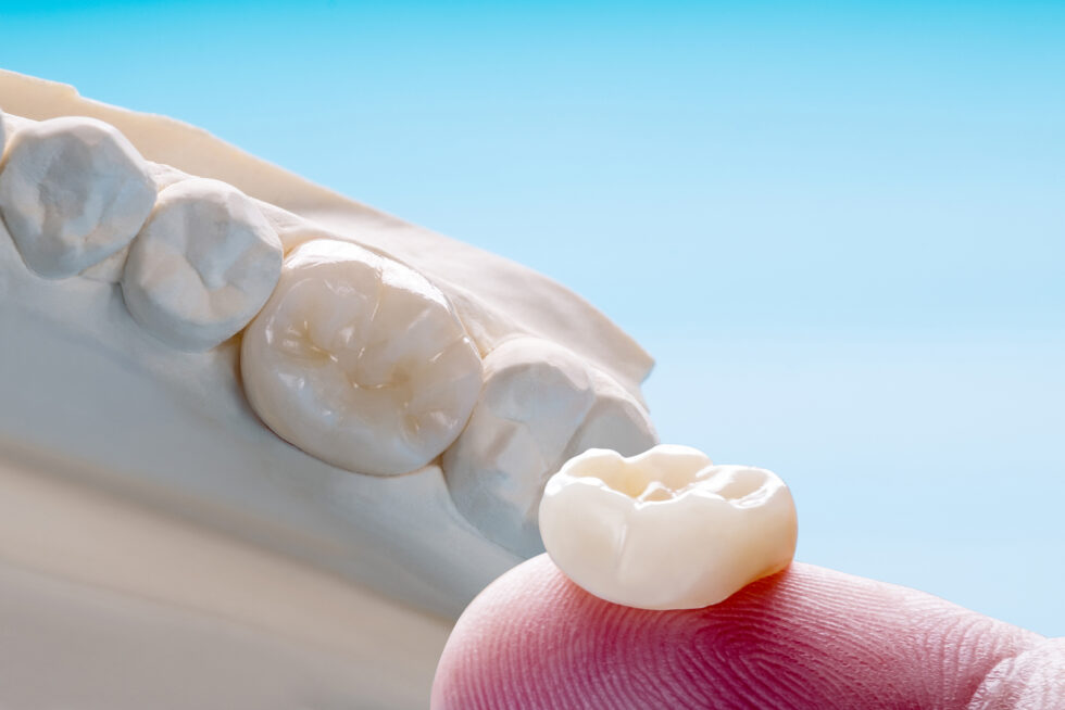 Closeup / Prosthodontics Or Prosthetic / Single Teeth Crown