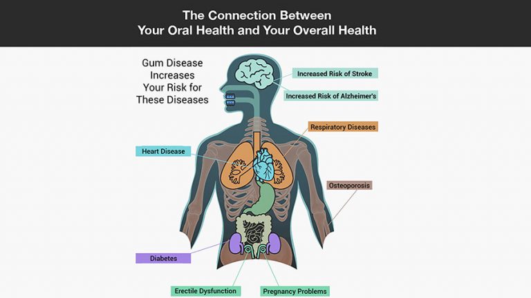Connection Between Oral Health And Overall Wellness