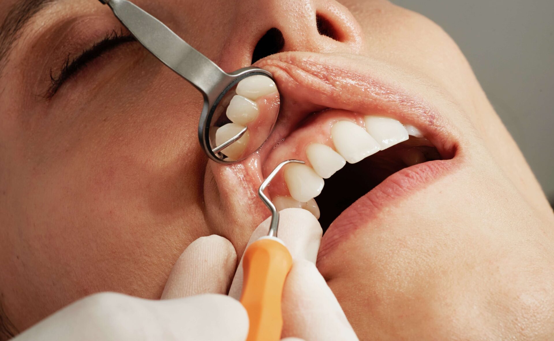 Dental Patient Having Their First Dental Checkup