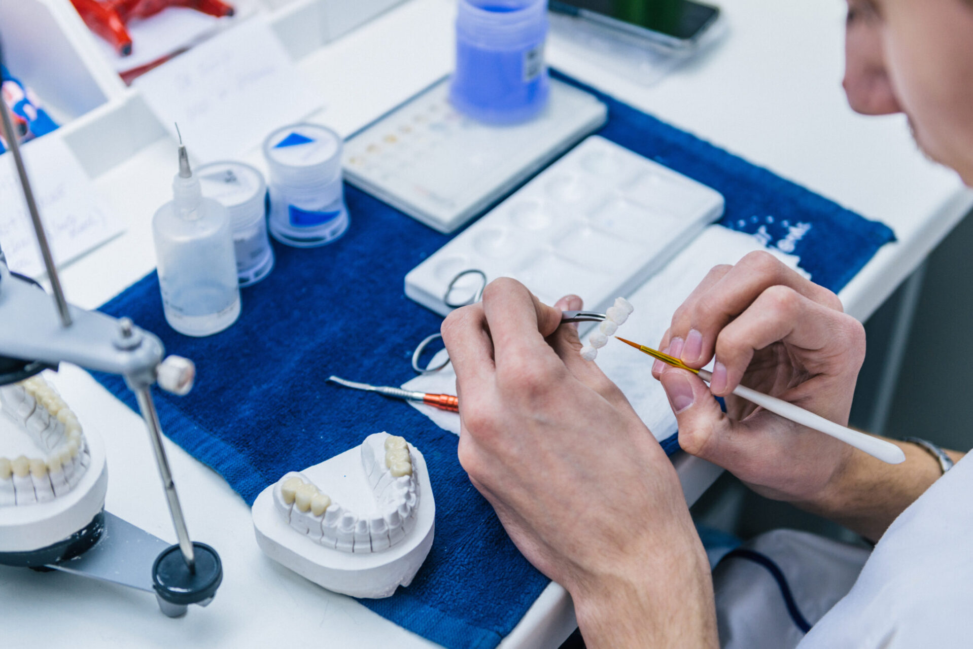 The Benefits Of All Ceramic Veneers