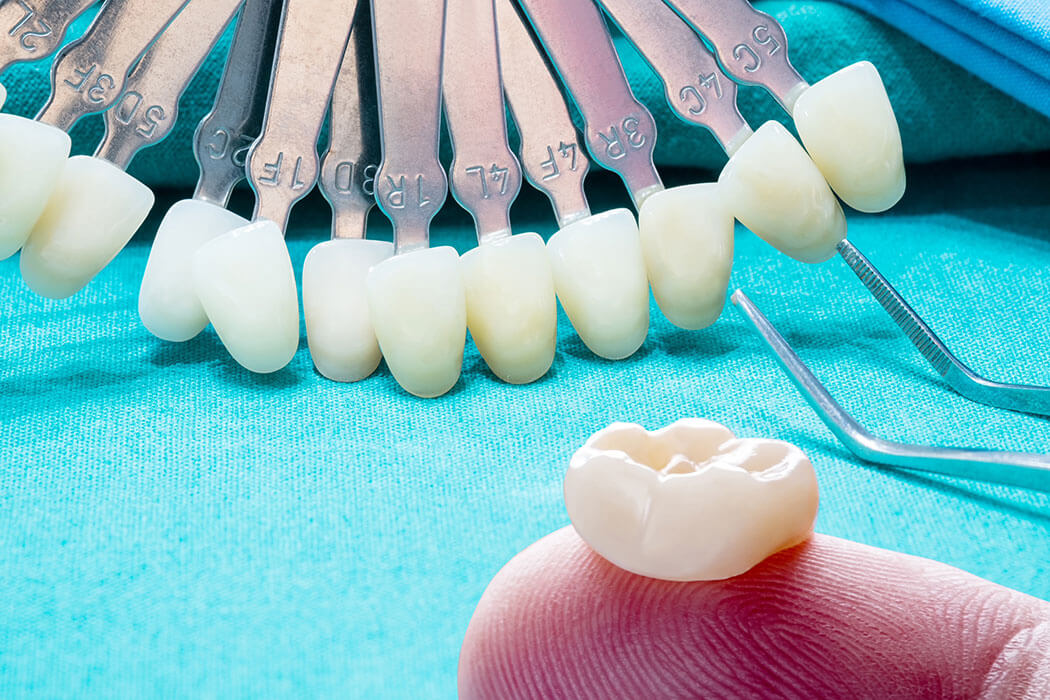 Crown Bridges Richmond Hill Centre Dental