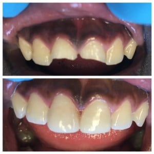Dental Care In Delhi