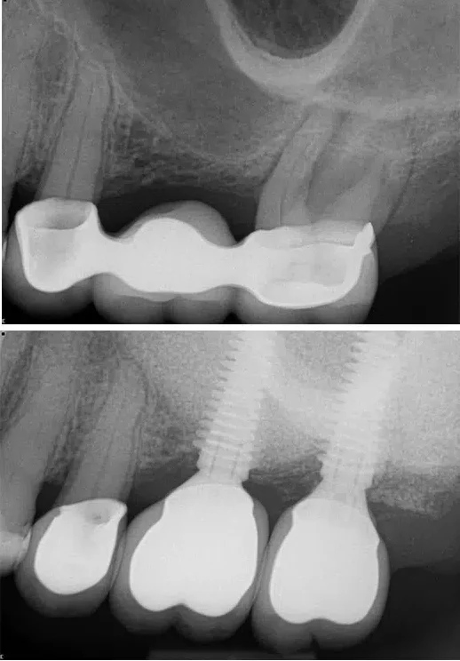Post Procedure