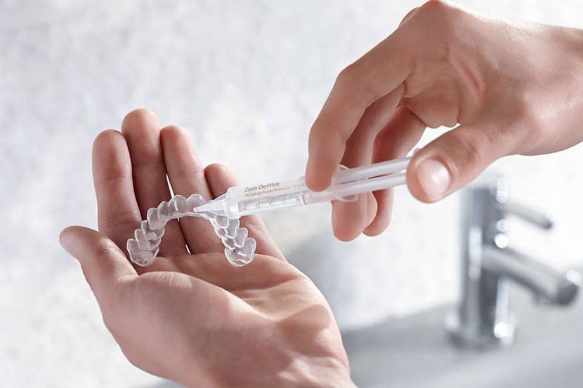 Professional Teeth Whitening Treatment