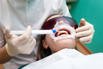 Teeth Whitening Treatment