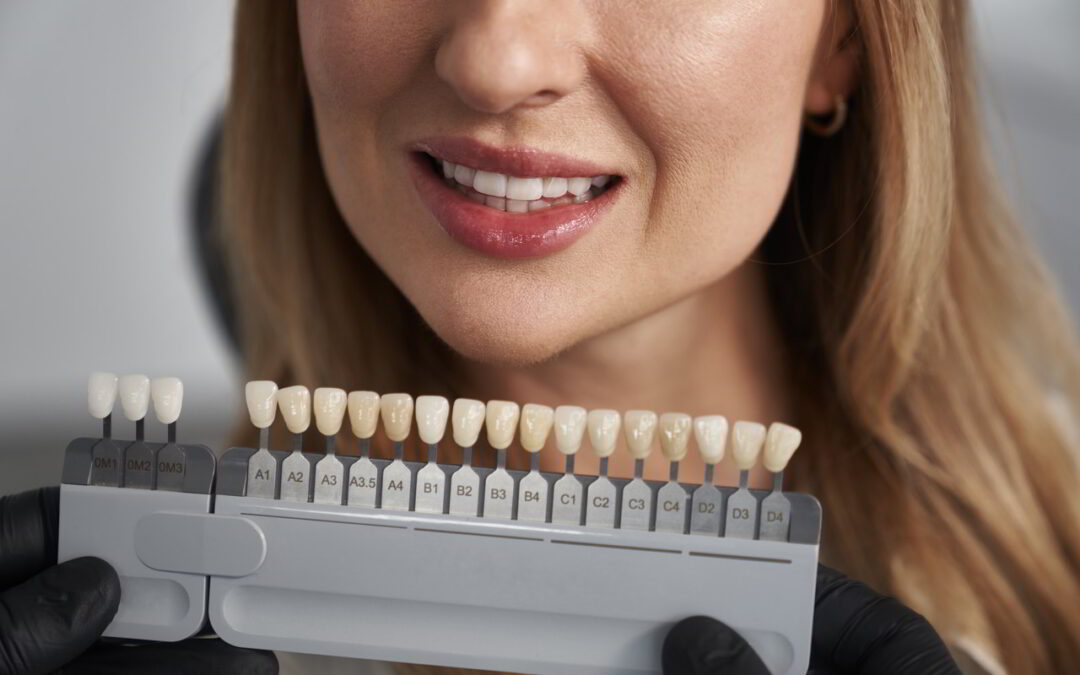 Ceramic Crowns Before After