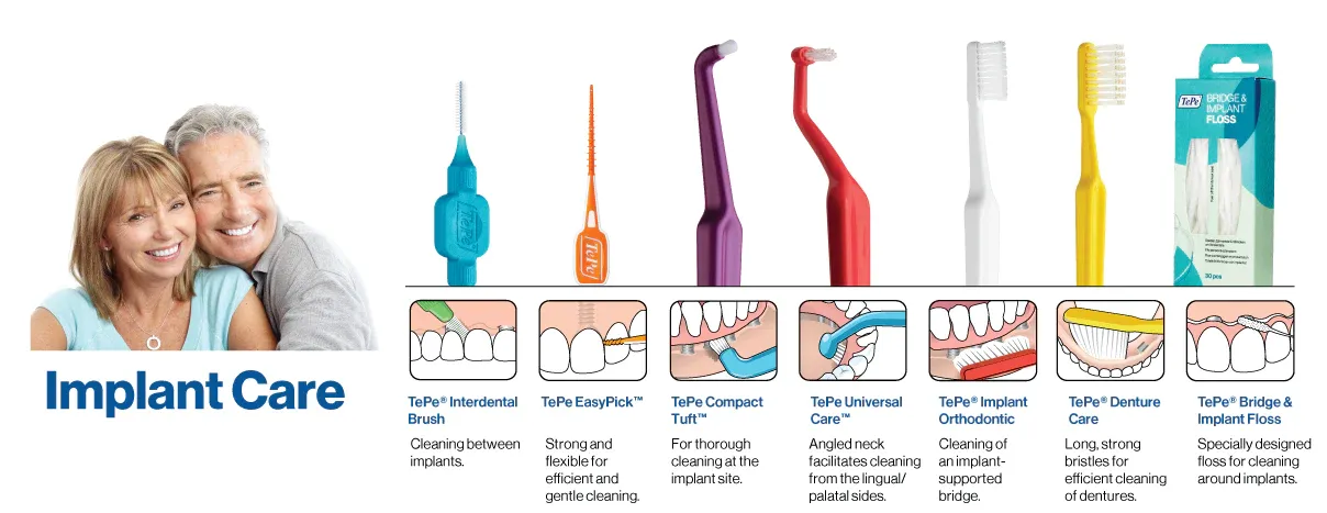 Maintaining Your Dental Implants