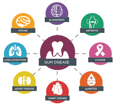 Connection Between Oral Health & Overall Health