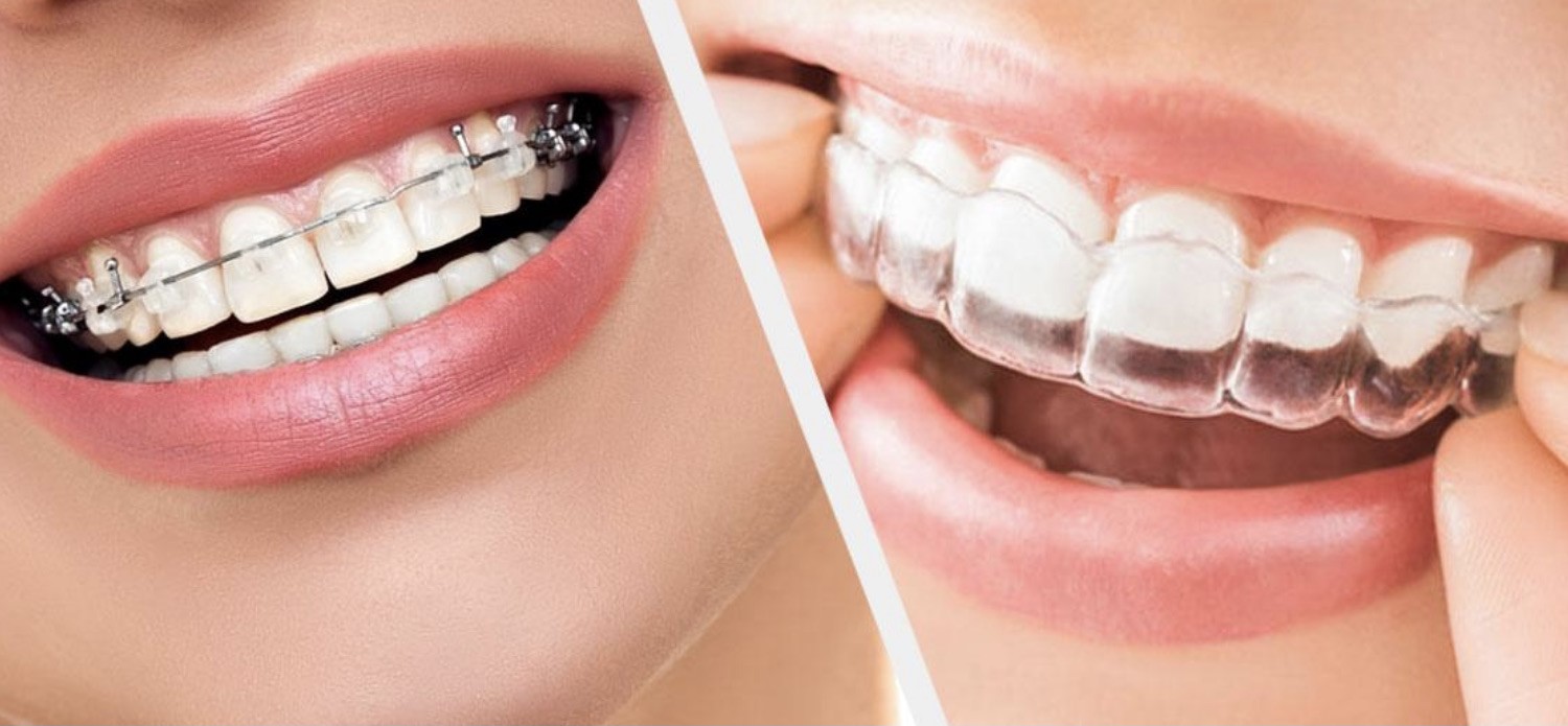 Treatments That Help Balanced Chewing